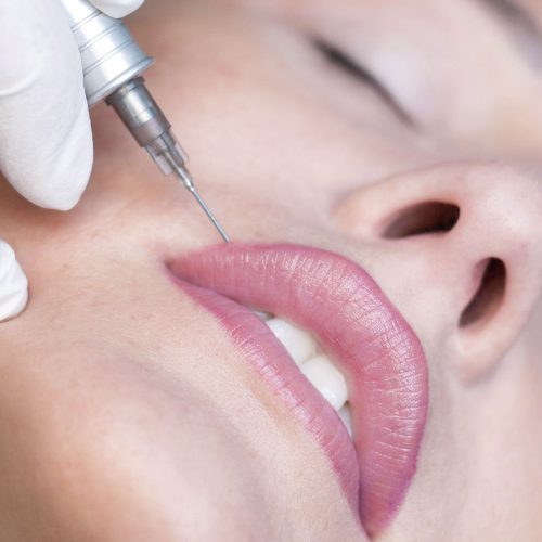 Permanent-Make-up für Lippen – was ist das und welche Effekte sichert eine solche Behandlung?
